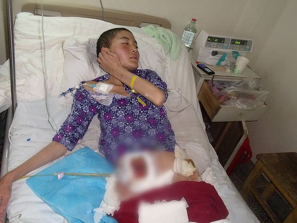 藏族女孩扎西求藏病情加重 再次紧急呼吁各界捐助
