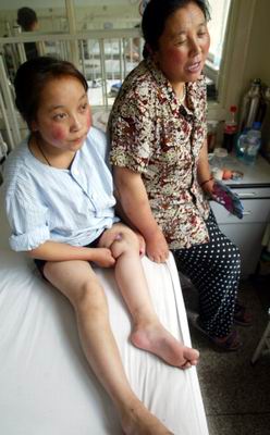 藏族女孩乔巴吉“怪病”在天津治愈